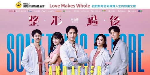 event-banner-《整形過後》温昇豪領銜跨界對談|戲劇到真實的唇腭裂人生修復