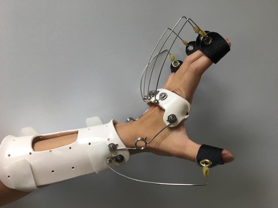 (透過3D列印客製輔具，更能提升使用者完善的生活環境。)