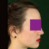 開房間計劃：腹語術